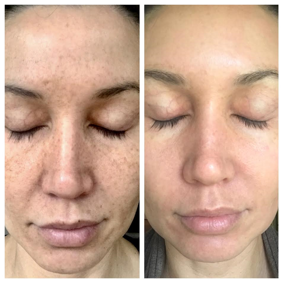 Dermatology Clinic Sun Damage Treatment